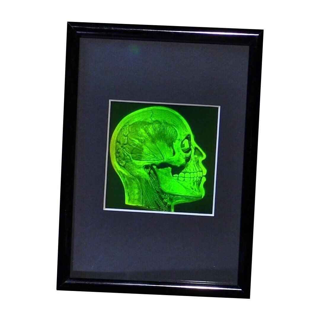 Brain/Skull 3D Photopoloymer Realistic 2-Channel 3D Hologram Picture - Framed